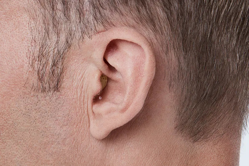Oticon invisible-in-the-canal Hearing Aid | St. George Audiology | Kerala