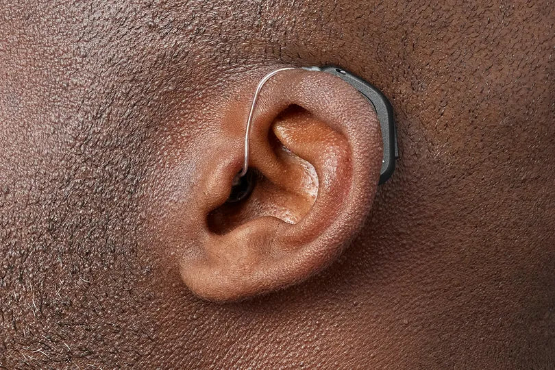 Oticon Intent 1 miniRITE Rechargeable Hearing Aid | One Pair With Powerbank Smart Charger